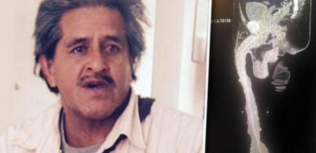 墨西哥54岁男子Roberto Esquivel Cabrera号称拥有世界最长阴茎
